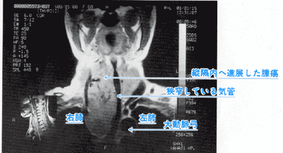 ＭＲＩ